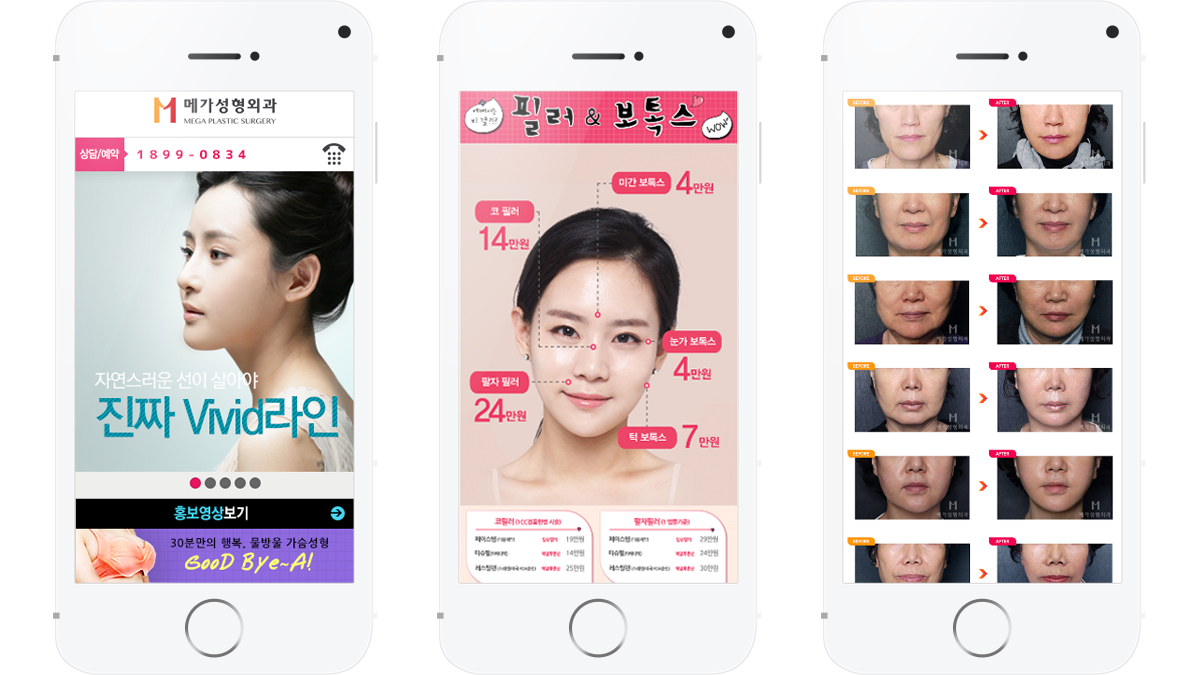 메가성형외과 병원웹사이트