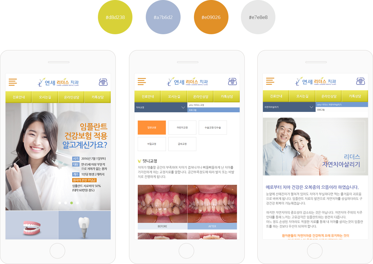 list_연세리더스치과_모바일04.jpg 발랄한 색감의 차별화된 동네치과 홈페이지 인터페이스