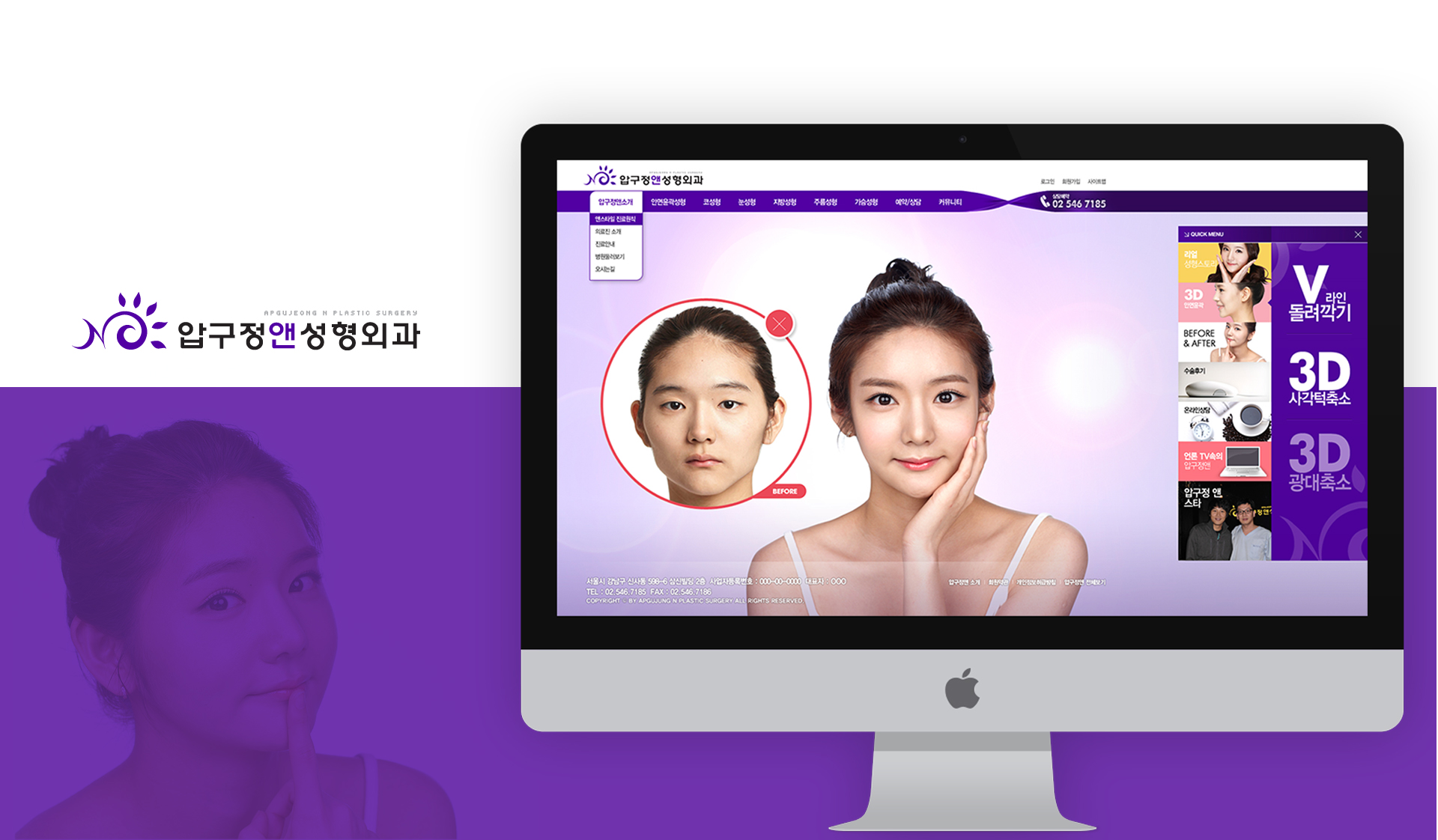 압구정앤성형외과_ 서울 홈페이지제작